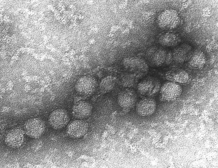 The West Nile virus is a spherical virus that causes violent fevers in human beings.  © DR