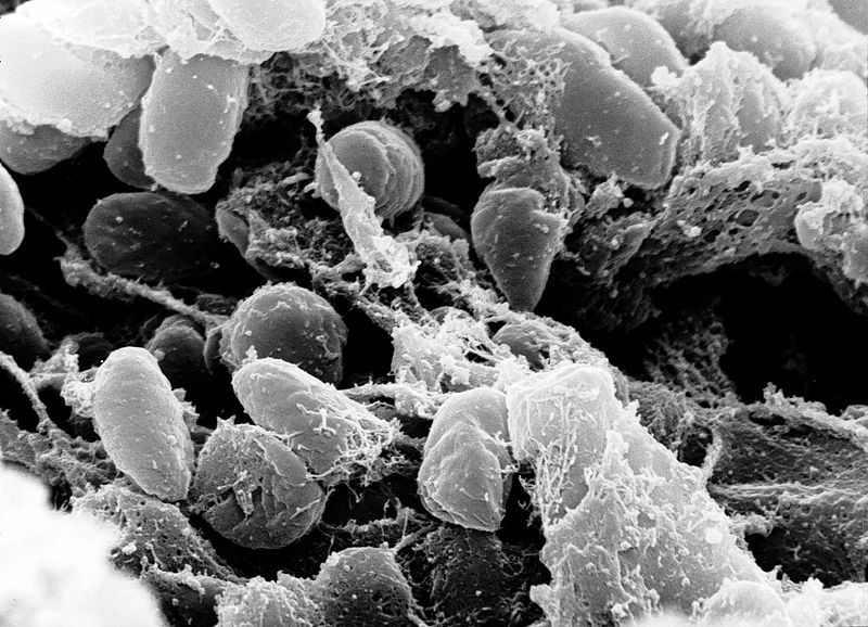 The agent responsible for the plaque is a bacterium called Yersinia pestis. © DR