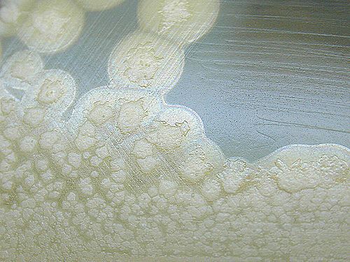 Clostridium botulinum produces toxins responsible for botulism. © hukuzatuna, Flickr, CC by-nc-nd 2.0