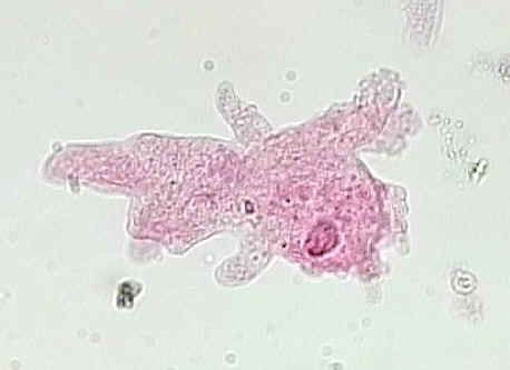 Amoeba: Proteus amoeba