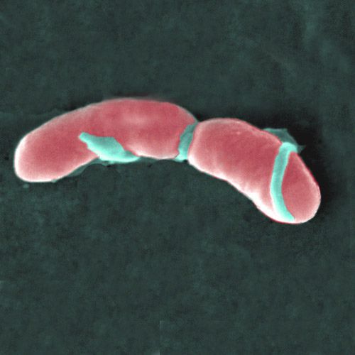 The Listeria monocytogenes bacterium is the agent responsible for listeriosis. © AJC1, Flickr, CC by-nc 2.0