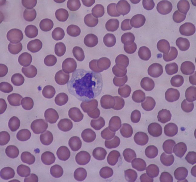 monocyte-bobigalindowikicc