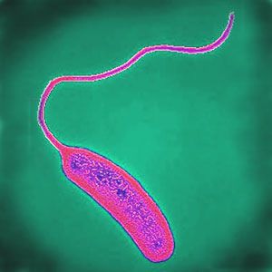 The cholera agent is the bacterium Vibrio cholerae, a flagellated bacillus. © AJC1, Flickr, CC by-nc 2.0
