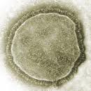 The measles virus is spherical and enveloped within a membrane. © AJC1, Flickr, CC by-nc-sa 2.0