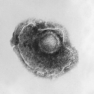 Seen here under transmission electron microscopy, varicella zoster virus causes vesicles to develop over the whole body. © DR