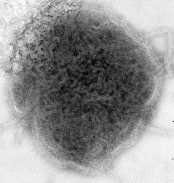 The mumps virus belongs to the Paramyxoviridaefamily. © DR