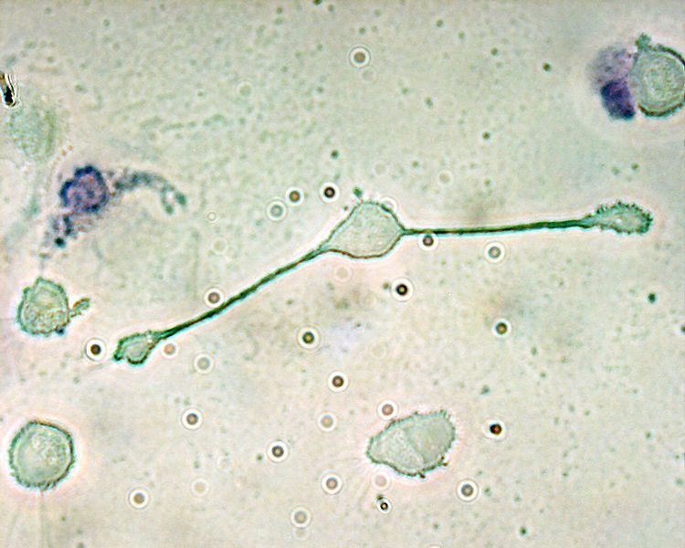 Macrophages can phagocytose foreign bodies. © Obli, Wikimedia, CC by-sa 2.0