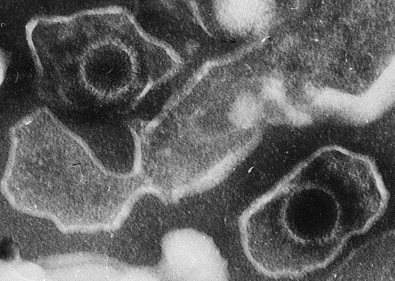 Epstein-Barr virus causes infectious mononucleosis. © Liza Gross, Wikimedia, CC by 2.5