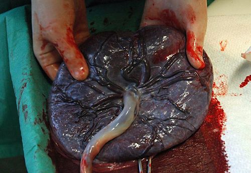 Human placenta Credit: Flickr (author Inferis) public domain