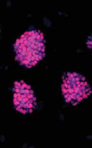The induced pluripotent stem cells are stained pink. © Nature methods