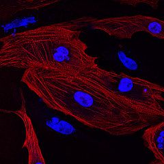 Cardiac cells, also called cardiac myocytes. © Arboreus CC by-nc