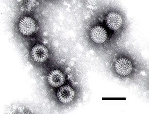 Their name rotavirus comes from their circular shape.  They are seen here by transmission electron microscopy. The black line represents 100 nm. © FP Williams, Wikipedia, DP