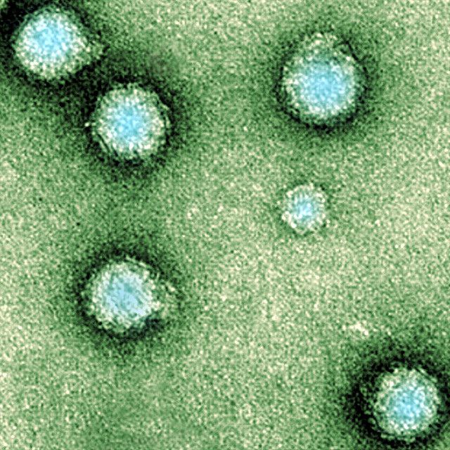 The Chikungunya virus is spherical in shape. © AJC1, Flickr, CC by-nc 2.0