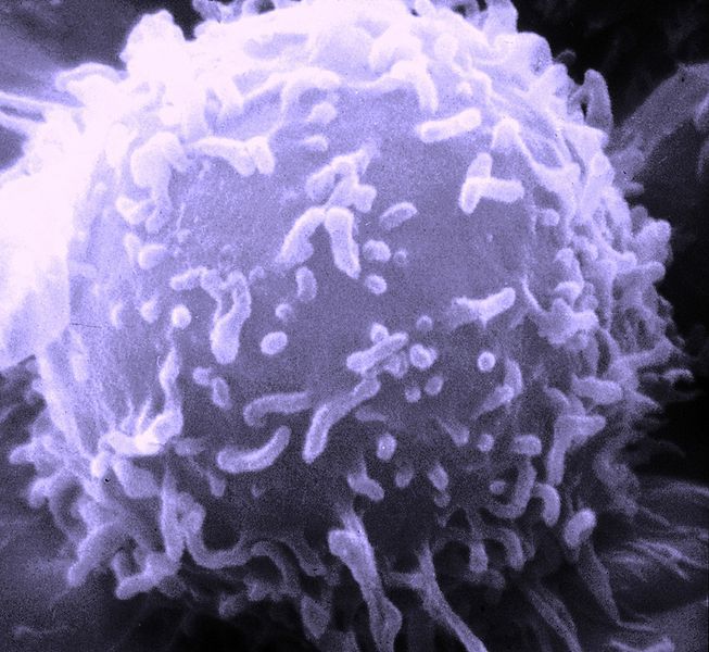 Lymphocytes are small round cells. © National Cancer Institute, Wikimedia, public domain