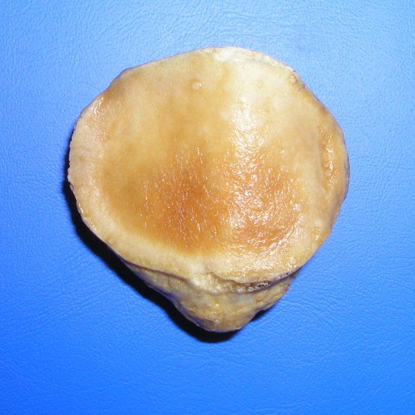 The patella is a triangular bone located in the knee. © Palica, Wikimedia, public domain