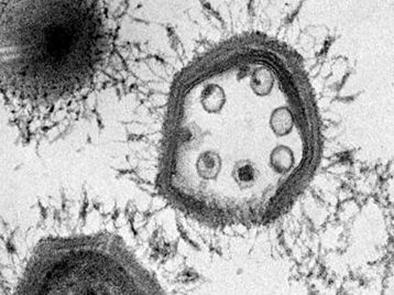 A virophage included in a Mimivirus capsid seen under transmission electron microscopy.  © Didier Raoult/CNRS