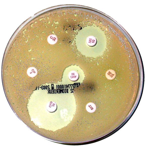 An antibiotic sensitivity profile on solid medium. © Wikimedia Commons