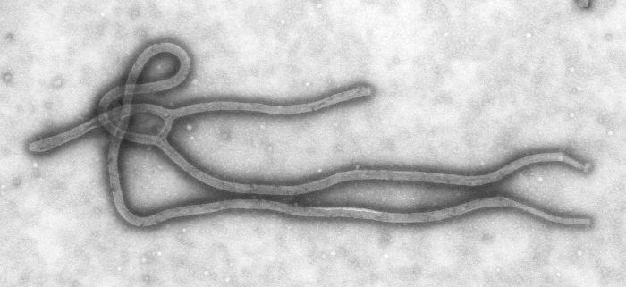 The Ebola virus has a filamentous viral particle. © DR
