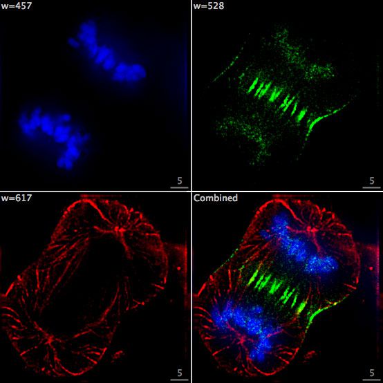 Mitosis is seen under an epifluorescence microscope using different fluorophores (DNA in blue, tubulin in red, and a centromere protein in green). © F. Lamiot, CC by-sa 3.0