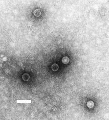 Poliovirus (seen in electron microscopy) has a replicase which has been widely studied in molecular biology. © DR